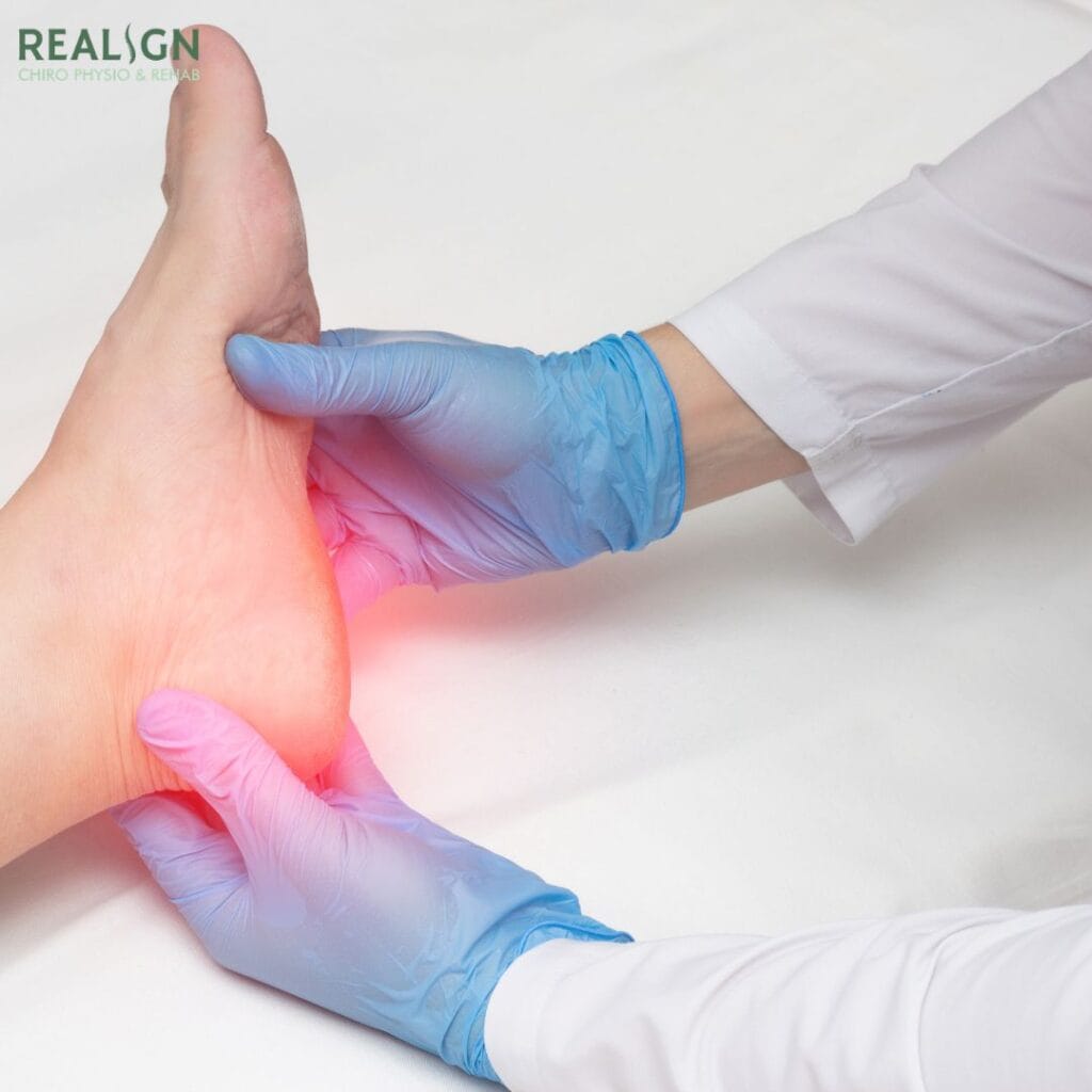 plantar fasciitis