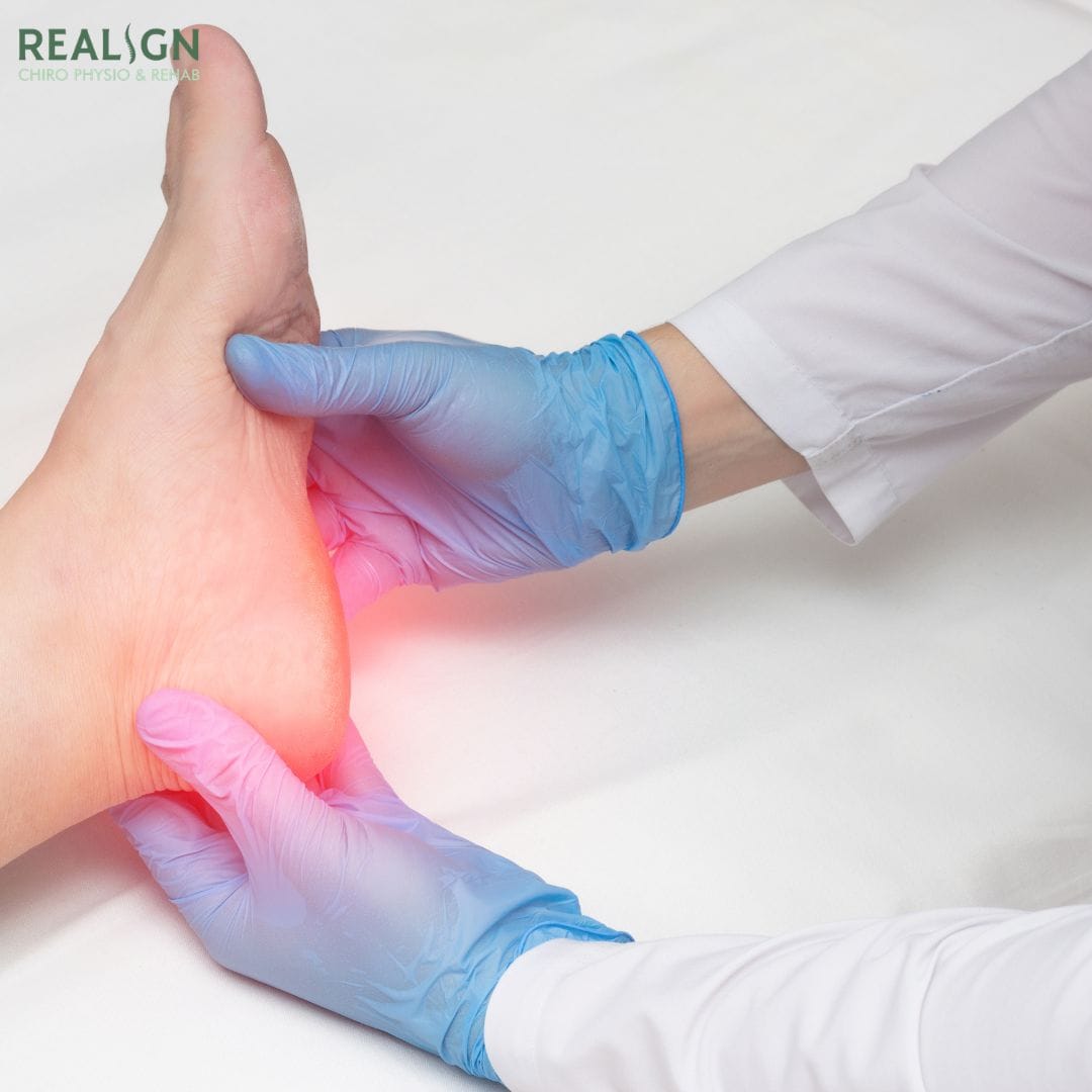 plantar fasciitis